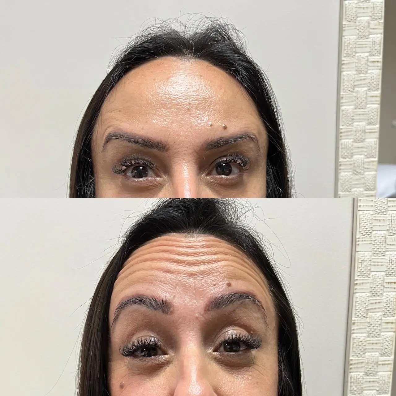 Resultado estético – antes e depois 4