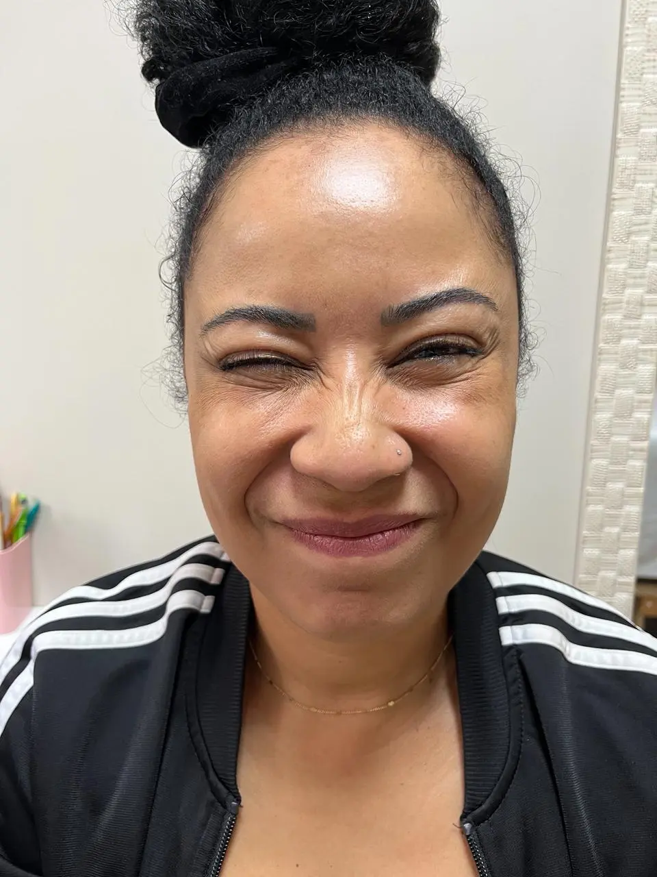 Depois – registro 1